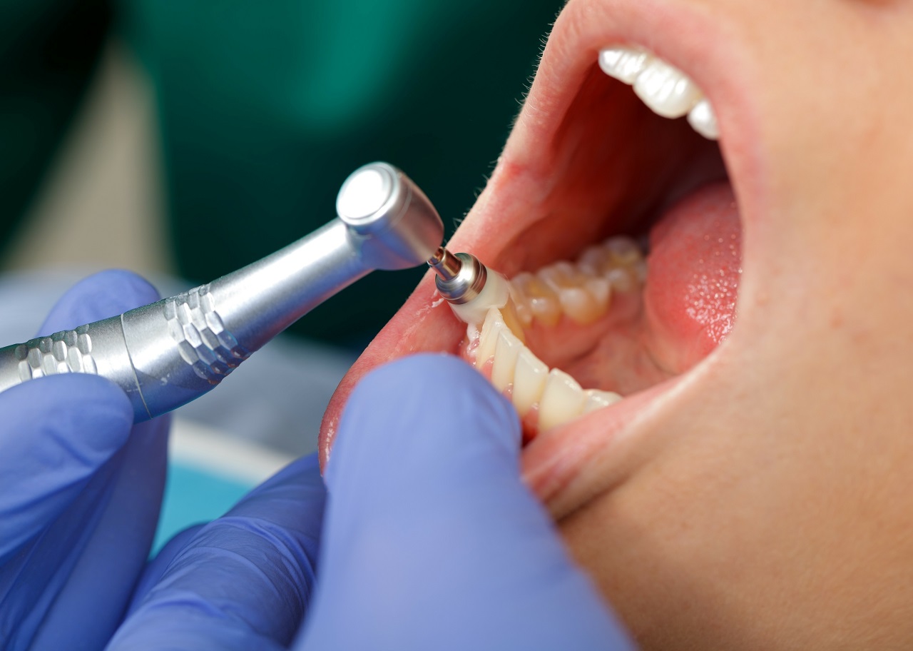 Zabiegi stomatologiczne i narzędzia potrzebne do ich przeprowadzenia